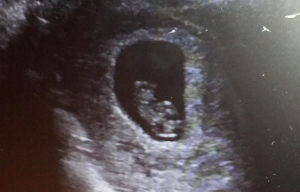 The littlest Baby G at 8 weeks + 5 days